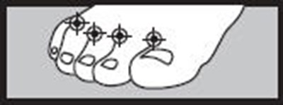 Figure 1 (Terbinafine 01)