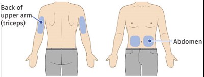 Image 3 (UDENYCA ONBODY injector)