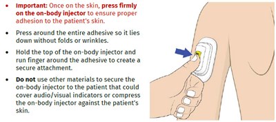 Image 15 (UDENYCA ONBODY injector)