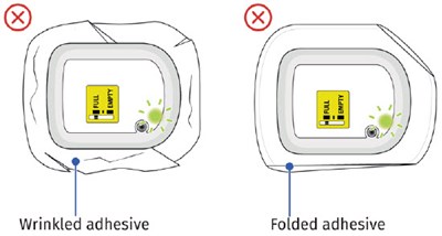 Image 19 (UDENYCA ONBODY injector)