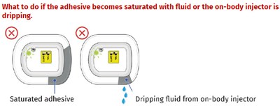 Image 21 (UDENYCA ONBODY injector)