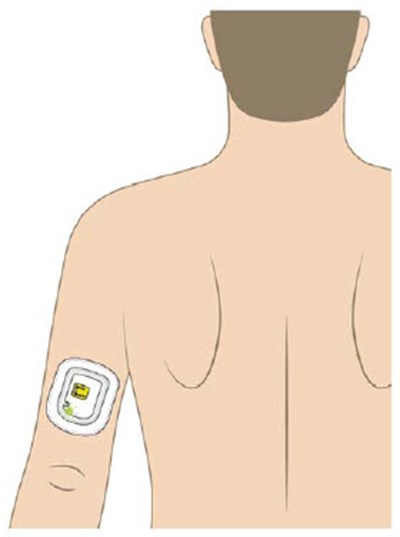 Image 4 (UDENYCA ONBODY injector)