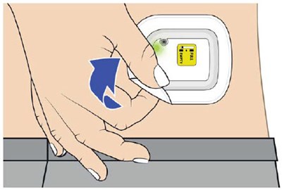 Image 8 (UDENYCA ONBODY injector)