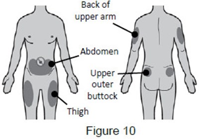Image Of Injection Site Selection (instructions for use)