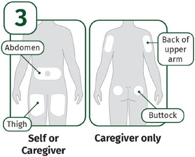 Image Of Choosing Injection Site (AI instructions for use)