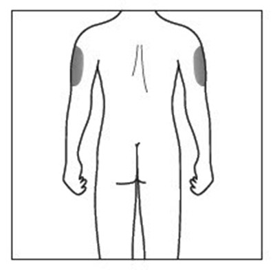 Figure D - cosentyx 11