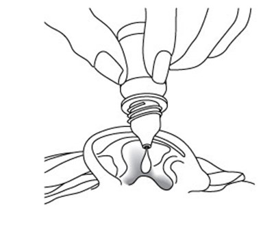 Eardrop (Eardrop)