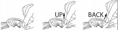 Upback (Upback)
