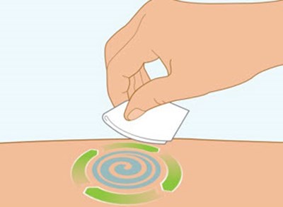 Image (Spevigo 26)