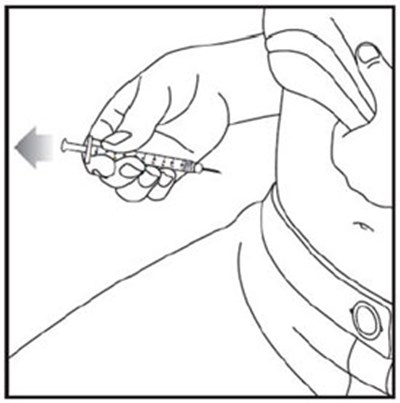 Figure (Moun Vial Ifu 20 V1)