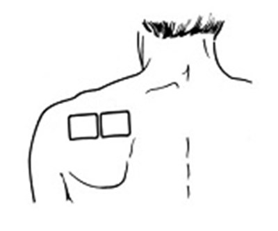 Figure B Instructions (Butrans Instr Figb)