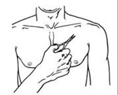 Figure C Instructions (Butrans Instr Figc)