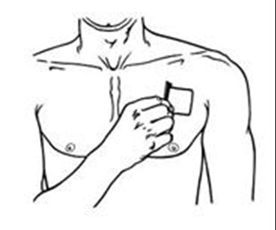 Figure G Instructions (Butrans Instr Figg)
