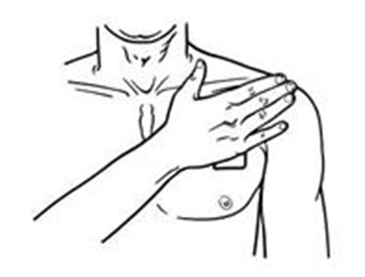 Figure I Instructions (Butrans Instr Figi)