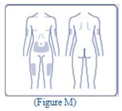 100 U/ml Ifu (Figure M)