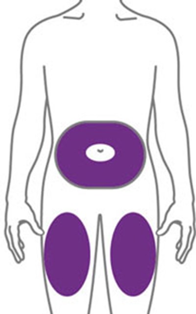 Figure (Ebglyss Ifu Inj Sites 1 V1)