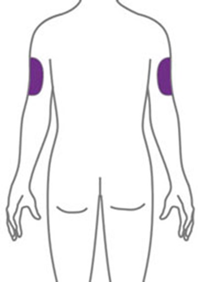 Figure (Ebglyss Ifu Inj Sites 2 V1)