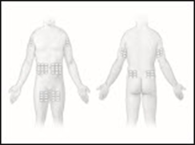 Figure 13 - hizentra 33