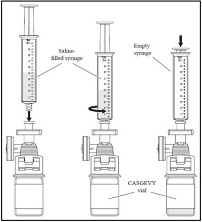 casgevy-03.jpg Image - casgevy 03