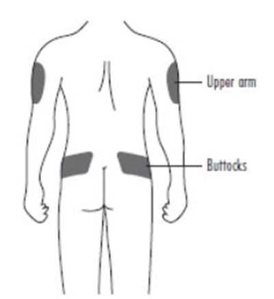 Ifu-fig-g (Image 05)