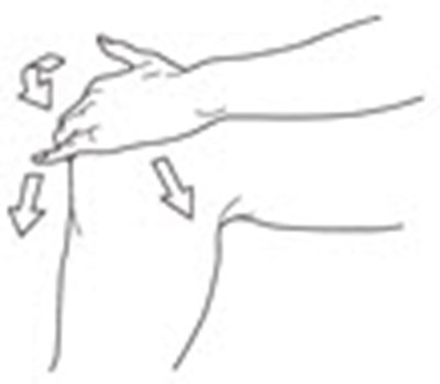 Figure C. - pennsaid 09