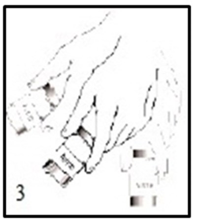 Figure 3 (Acthib 03)