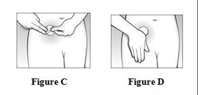 Figure C,D - combipatch figure 6