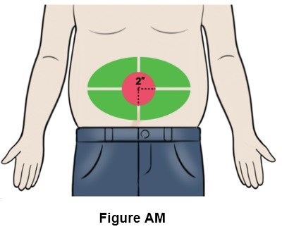 Figure Am (Egr00 0001 46)