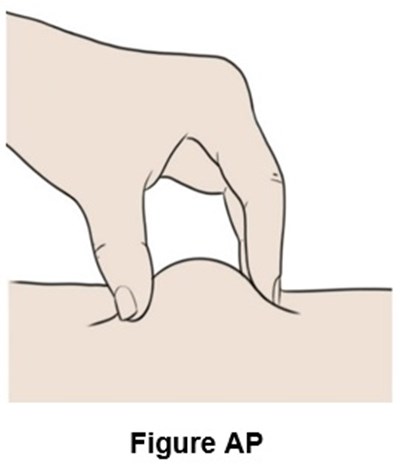 Figure Ap (Egr00 0001 49)