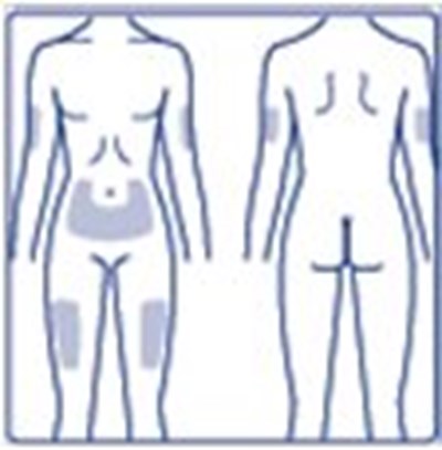 Vial IFU-figure J - image 13