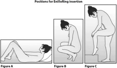 image description - enilloring figure 6