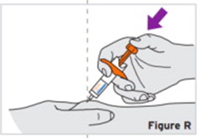 tocli-img-56.jpg - tocil img 56