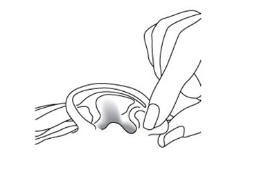Earpull (895c2307 Aeeb 49fd Ac3d 750a463fc3ef 08)