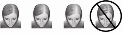 Hair Loss Image (Image 01)
