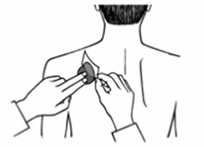 Figure E (Rivastigmine Transdermal System 14)