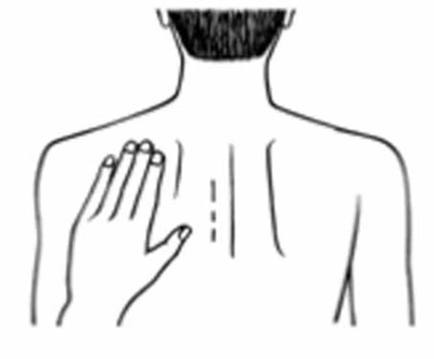 Figure F (Rivastigmine Transdermal System 15)