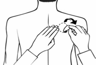 Figure G (Rivastigmine Transdermal System 16)