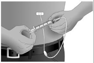 Step 9b (Step9bbw)