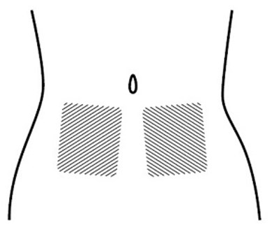 Icatibant-fig-f (Icatibant Fig F)