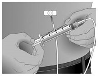 Step 12 A (Step12)