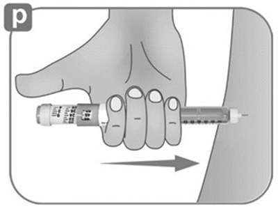 Instructions For Use Figure P (Image 28)