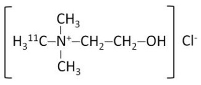 choline-c-11-injection-01.jpg choline c 11 injection 01