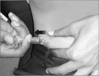 Figure F. - fondaparinux fig14