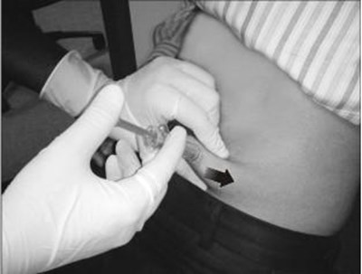 Figure 2 - fondaparinux fig2