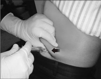 Figure 3 - fondaparinux fig3