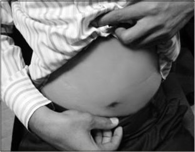 Figure A. - fondaparinux fig9