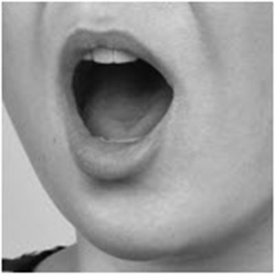 Figure 4d - fentanyl 13