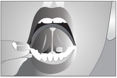 spl-figure - spl figure