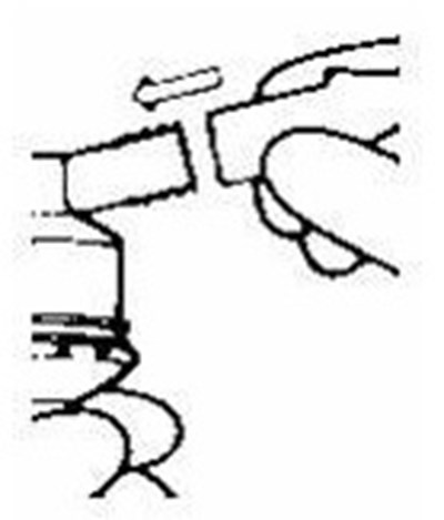 Image Description (Albuterol Figure 2)