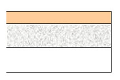 neupro-02.jpg Figure - neupro 02